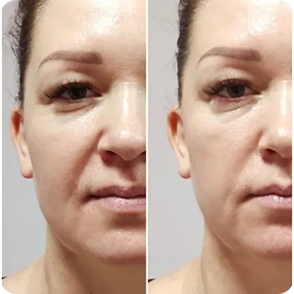 Результат после сеанса