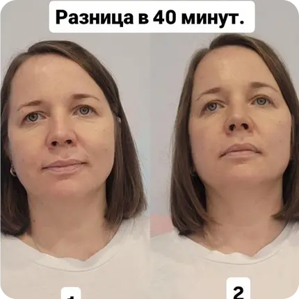 Результат после сеанса